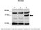 RCAN Family Member 3 antibody, A11135, Boster Biological Technology, Western Blot image 