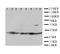 Voltage Dependent Anion Channel 1 antibody, LS-C312926, Lifespan Biosciences, Western Blot image 