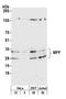 Mitochondrial Fission Factor antibody, A305-638A-M, Bethyl Labs, Western Blot image 