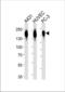EGFR antibody, TA324809, Origene, Western Blot image 