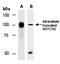 CD20 antibody, orb67092, Biorbyt, Western Blot image 