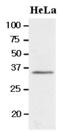 BRCA1/BRCA2-Containing Complex Subunit 3 antibody, GTX50015, GeneTex, Western Blot image 