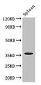Fc Fragment Of IgG Receptor IIa antibody, orb46203, Biorbyt, Western Blot image 