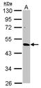 Cytochrome P450 Family 3 Subfamily A Member 43 antibody, NBP2-16064, Novus Biologicals, Western Blot image 