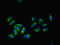 Regulator Of G Protein Signaling 2 antibody, LS-C370233, Lifespan Biosciences, Immunofluorescence image 