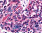 Steroid hormone receptor ERR2 antibody, TA316719, Origene, Immunohistochemistry paraffin image 