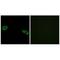 Ribosomal Protein S4 Y-Linked 1 antibody, A11919, Boster Biological Technology, Immunohistochemistry frozen image 