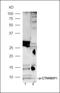 Catenin Beta Interacting Protein 1 antibody, orb4462, Biorbyt, Western Blot image 