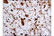 Gelsolin antibody, 12953S, Cell Signaling Technology, Immunohistochemistry paraffin image 