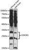 Cyclin Dependent Kinase 5 Regulatory Subunit 1 antibody, LS-C749498, Lifespan Biosciences, Western Blot image 