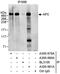 APC Regulator Of WNT Signaling Pathway antibody, A300-981A, Bethyl Labs, Immunoprecipitation image 