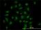 Homeodomain-interacting protein kinase 1 antibody, H00204851-M07, Novus Biologicals, Immunofluorescence image 
