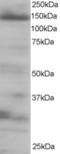 Eukaryotic Translation Initiation Factor 4E Nuclear Import Factor 1 antibody, STJ70487, St John