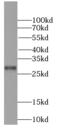 Protein Phosphatase 1 Regulatory Inhibitor Subunit 11 antibody, FNab06699, FineTest, Western Blot image 