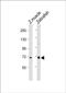 WW Domain Containing Adaptor With Coiled-Coil antibody, PA5-72258, Invitrogen Antibodies, Western Blot image 
