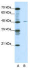 NFI-X antibody, TA331123, Origene, Western Blot image 