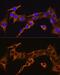 Bradykinin Receptor B2 antibody, GTX64939, GeneTex, Immunocytochemistry image 