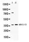 Aldo-keto reductase family 1 member C2 antibody, LS-C662323, Lifespan Biosciences, Western Blot image 