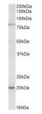 2'-5'-Oligoadenylate Synthetase 2 antibody, orb178374, Biorbyt, Western Blot image 