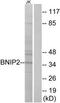 BCL2 Interacting Protein 2 antibody, TA313514, Origene, Western Blot image 