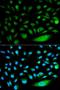 SMAD Family Member 1 antibody, LS-C331261, Lifespan Biosciences, Immunofluorescence image 