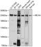 ATP Binding Cassette Subfamily A Member 4 antibody, 13-720, ProSci, Western Blot image 