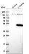 Chromosome 10 Open Reading Frame 88 antibody, PA5-59380, Invitrogen Antibodies, Western Blot image 