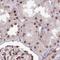 SS18 Subunit Of BAF Chromatin Remodeling Complex antibody, HPA059539, Atlas Antibodies, Immunohistochemistry frozen image 