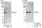 Echinoderm microtubule-associated protein-like 4 antibody, A301-909A, Bethyl Labs, Immunoprecipitation image 
