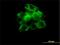 Chaperonin Containing TCP1 Subunit 2 antibody, H00010576-M01, Novus Biologicals, Immunocytochemistry image 