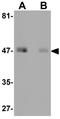 Receptor expression-enhancing protein 4 antibody, GTX31796, GeneTex, Western Blot image 