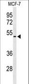CCT antibody, LS-C166187, Lifespan Biosciences, Western Blot image 