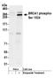 BRCA1 DNA Repair Associated antibody, A300-001A, Bethyl Labs, Western Blot image 