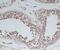 Brain Derived Neurotrophic Factor antibody, M00035-1, Boster Biological Technology, Immunohistochemistry paraffin image 