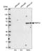 Pre-MRNA Processing Factor 31 antibody, HPA041939, Atlas Antibodies, Western Blot image 