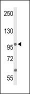 Anoctamin-7 antibody, LS-C156363, Lifespan Biosciences, Western Blot image 