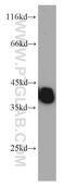 Tropomyosin 3 antibody, 10737-1-AP, Proteintech Group, Western Blot image 