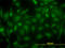 B-CK antibody, LS-C196922, Lifespan Biosciences, Immunofluorescence image 
