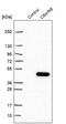 Chromosome 8 Open Reading Frame 48 antibody, PA5-55293, Invitrogen Antibodies, Western Blot image 