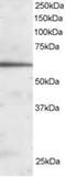 Forkhead Box A2 antibody, ab5074, Abcam, Western Blot image 