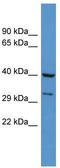 Dual Specificity Phosphatase 11 antibody, TA345842, Origene, Western Blot image 