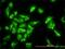 Elongation factor 1-gamma antibody, H00001937-M01, Novus Biologicals, Immunocytochemistry image 