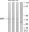 CDK-activating kinase assembly factor MAT1 antibody, GTX87969, GeneTex, Western Blot image 