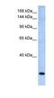 F-Box And WD Repeat Domain Containing 10 antibody, NBP1-79496, Novus Biologicals, Western Blot image 