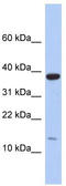 Ribosomal Protein L27 antibody, TA336209, Origene, Western Blot image 