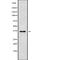 Atonal BHLH Transcription Factor 8 antibody, abx148407, Abbexa, Western Blot image 