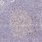Derlin 2 antibody, HPA056551, Atlas Antibodies, Immunohistochemistry paraffin image 