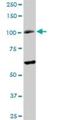 DNA repair and recombination protein RAD54B antibody, H00025788-D01P, Novus Biologicals, Western Blot image 