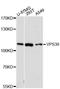 Vam6/Vps39-like protein antibody, LS-C748143, Lifespan Biosciences, Western Blot image 