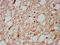 Homeobox D1 antibody, CSB-PA884426LA01HU, Cusabio, Immunohistochemistry frozen image 